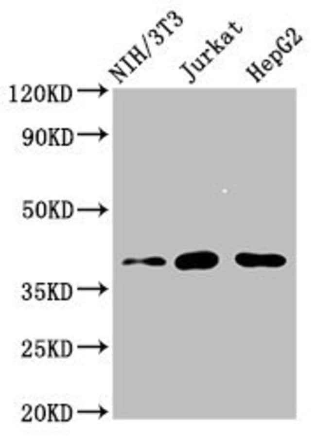 100UG RNF2 ANTIBODY 100 ug