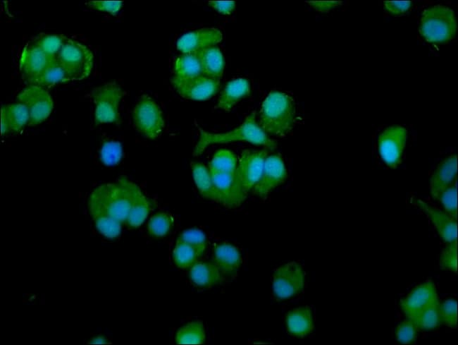 100UG TCP-1 ETA ANTIBODY 100 ug