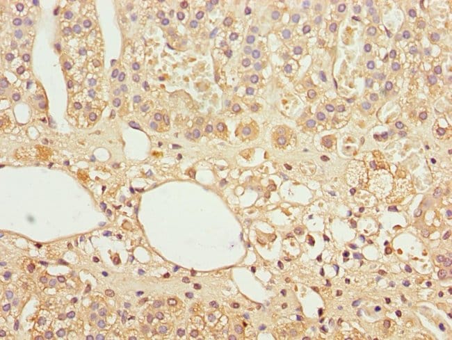 100UL GAS2L1 ANTIBODY 100 ul