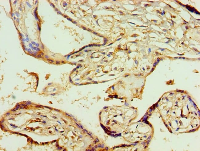 100UL AGPAT1 ANTIBODY 100 ul