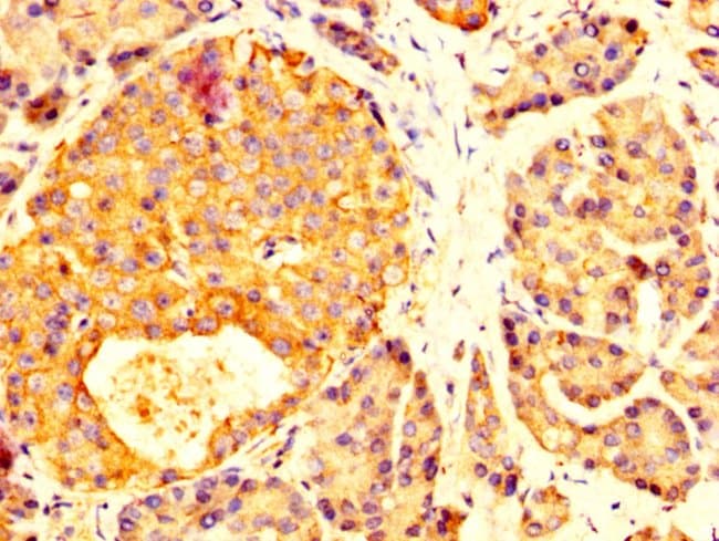 100UG MYOC ANTIBODY 100 ug