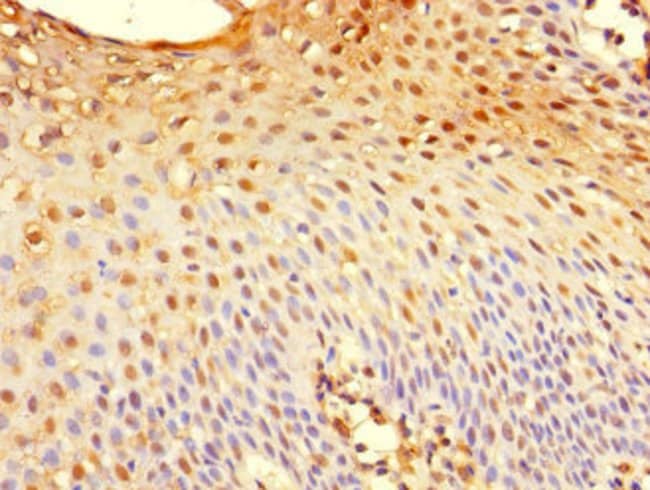 100UG GILZ ANTIBODY 100 ug
