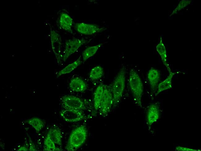 100UG PITX2 ANTIBODY 100 ug