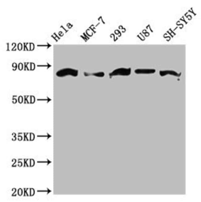 100UG BARD1 ANTIBODY 100 ug