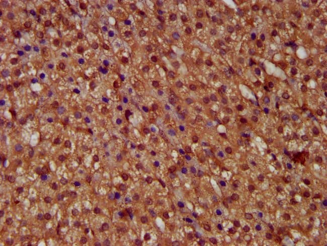 100UG MICU1 ANTIBODY 100 ug