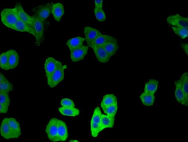 100UG CALPONIN 2 ANTIBODY 100 ug