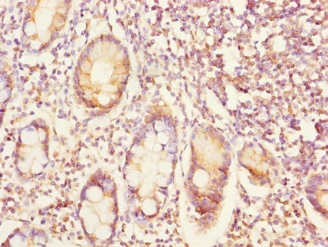 100UL EYA3 ANTIBODY 100 ul