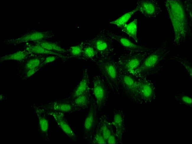 100UG NPAS2 ANTIBODY 100 ug