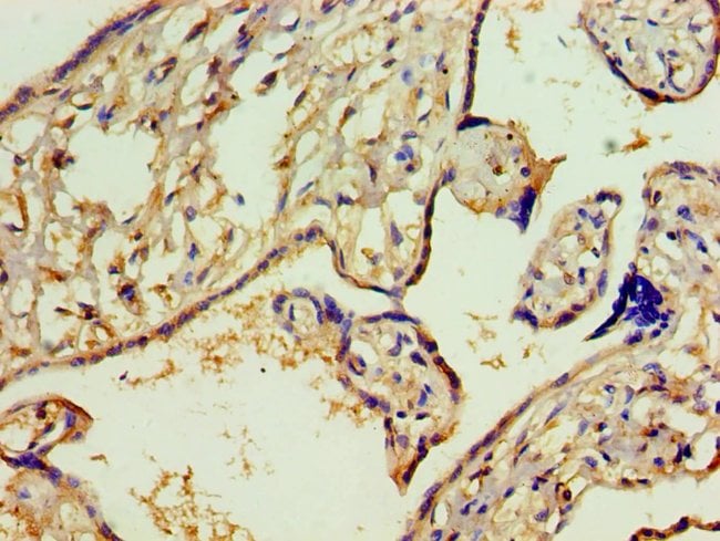 100UL AMINOACYLASE ANTIBODY 100 ul