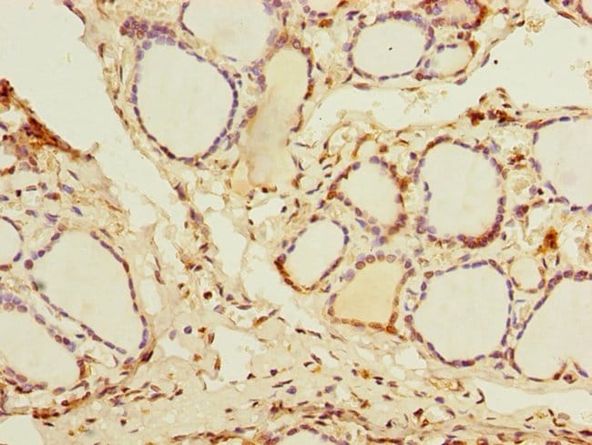 100UG DDX50 ANTIBODY 100 ug