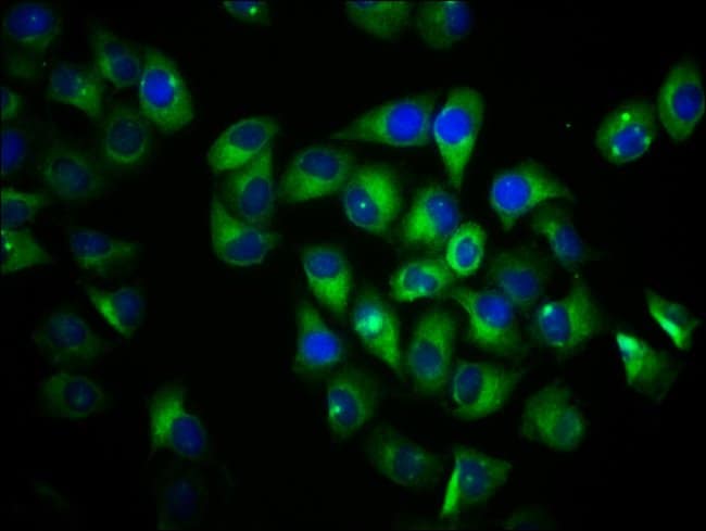 100UG VN1R1 ANTIBODY 100 ug