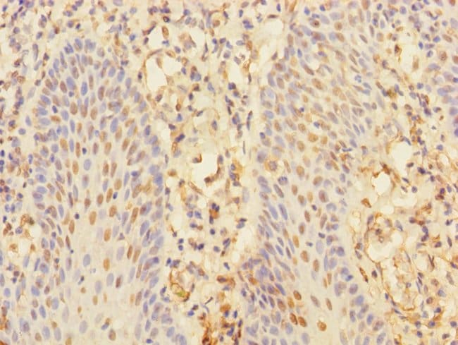 100UL CHRNA10 ANTIBODY 100 ul
