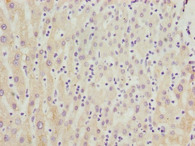 100UL CYP3A43 ANTIBODY 100 ul