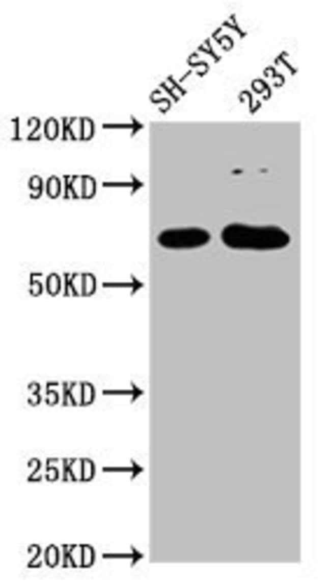 100UG GALNT9 ANTIBODY 100 ug