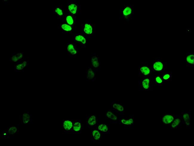 100UG XAB2 ANTIBODY 100 ug