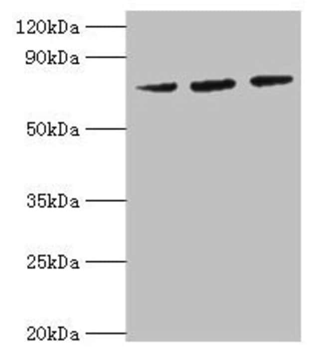 100UG HSPA6 ANTIBODY 100 ug