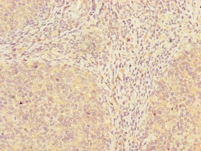 100UG ADAT1 ANTIBODY 100 ug