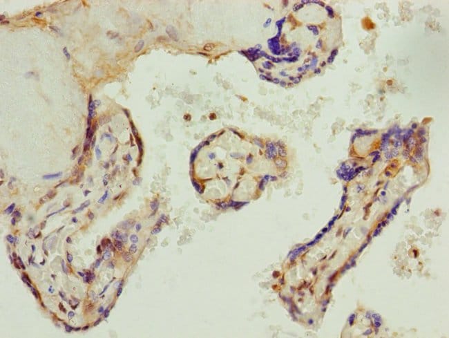 100UL AP1M1 ANTIBODY 100 ul