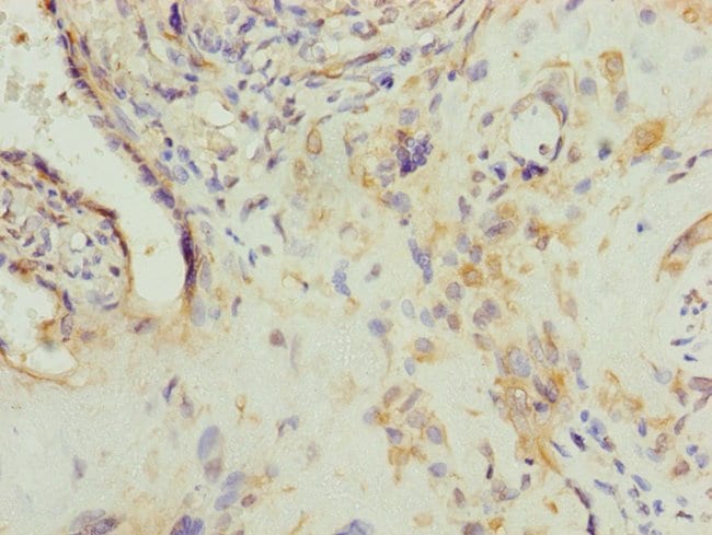 100UL AP1M1 ANTIBODY 100 ul