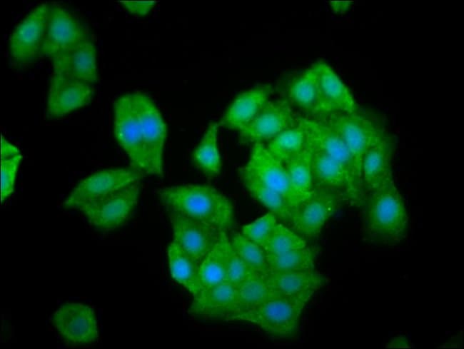 100UG NLN ANTIBODY 100 ug