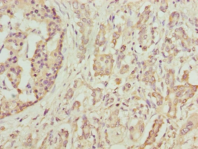 100UG DEFB129 ANTIBODY 100 ug