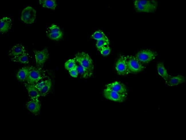 100UG ABCG5 ANTIBODY 100 ug