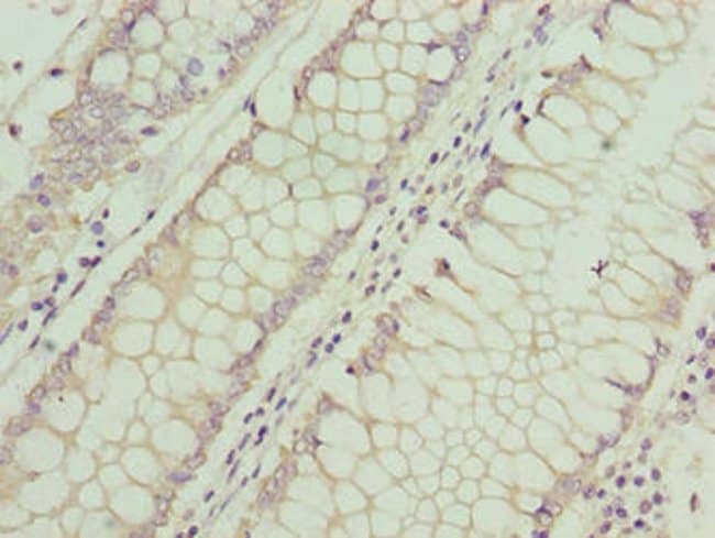 100UG ASB7 ANTIBODY 100 ug