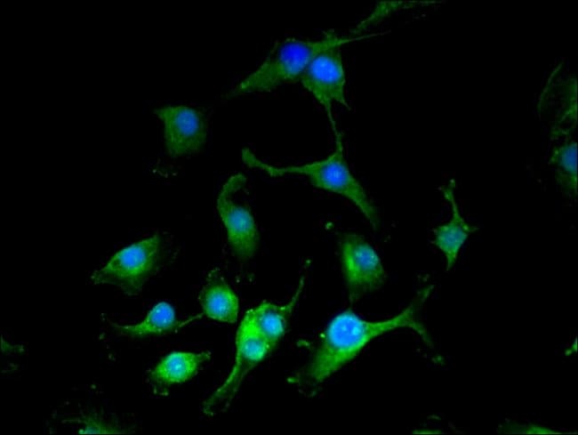 100UG NARFL ANTIBODY 100 ug