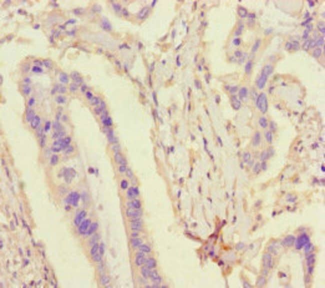100UG TDRD3 ANTIBODY 100 ug