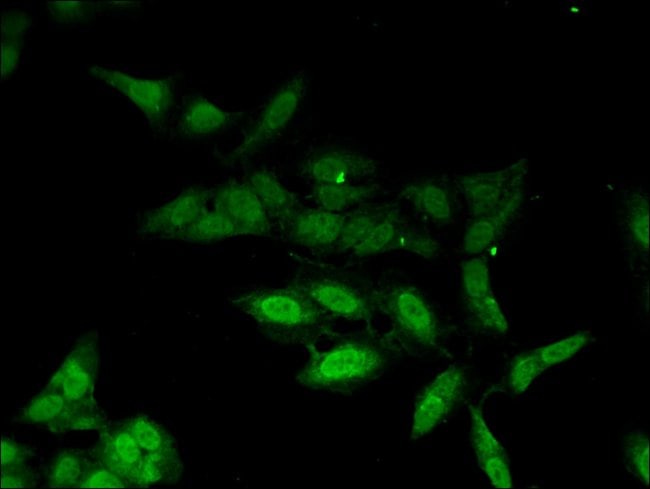 100UG PHAX ANTIBODY 100 ug