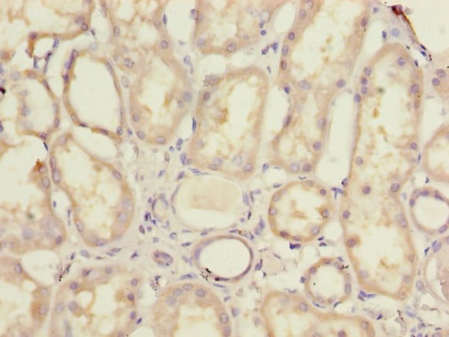 100UG MRPL44 ANTIBODY 100 ug