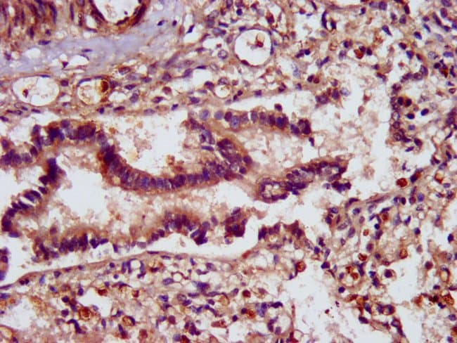 100UG SCUBE2 ANTIBODY 100 ug