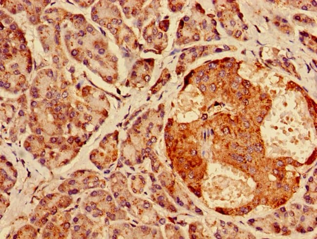 100UG AGPAT3 ANTIBODY 100 ug
