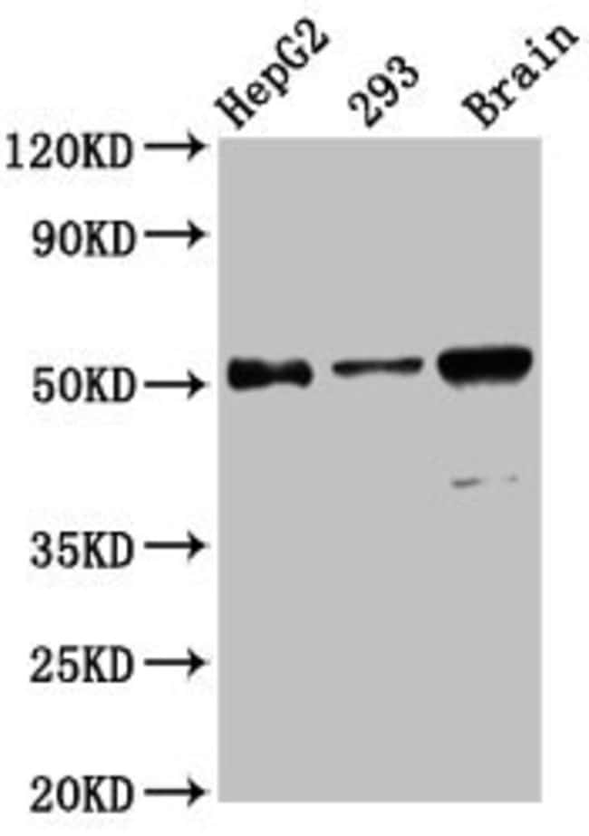 100UG ZFP57 ANTIBODY 100 ug