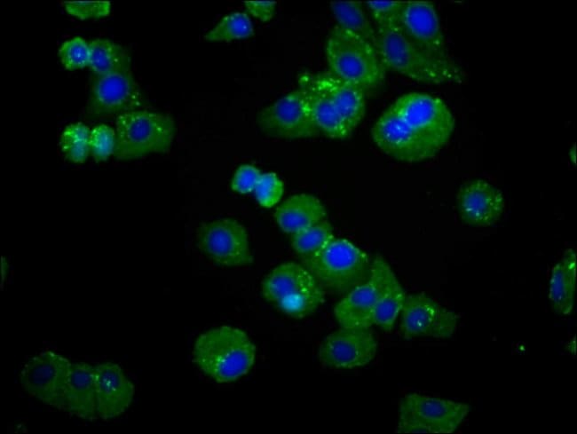 100UG SPTLC3 ANTIBODY 100 ug