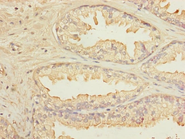 100UL KLHL13 ANTIBODY 100 ul