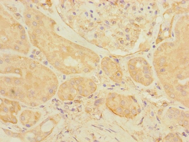 100UL EIF3K ANTIBODY 100 ul