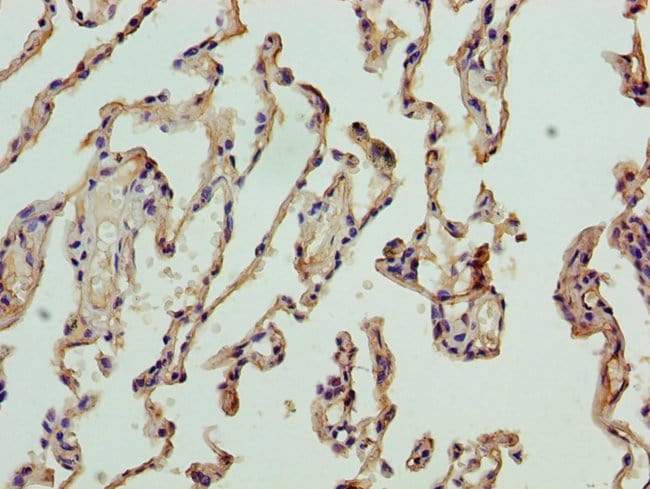 100UG NICN1 ANTIBODY 100 ug