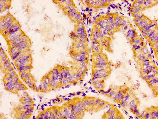 100UG CHRDL1 ANTIBODY 100 ug