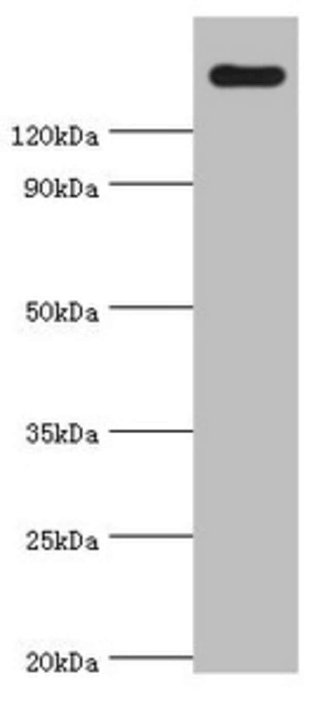 100UL CARD11 ANTIBODY 100 ul