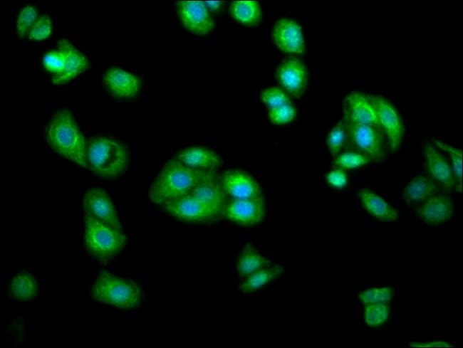 100UG AGXT2 ANTIBODY 100 ug
