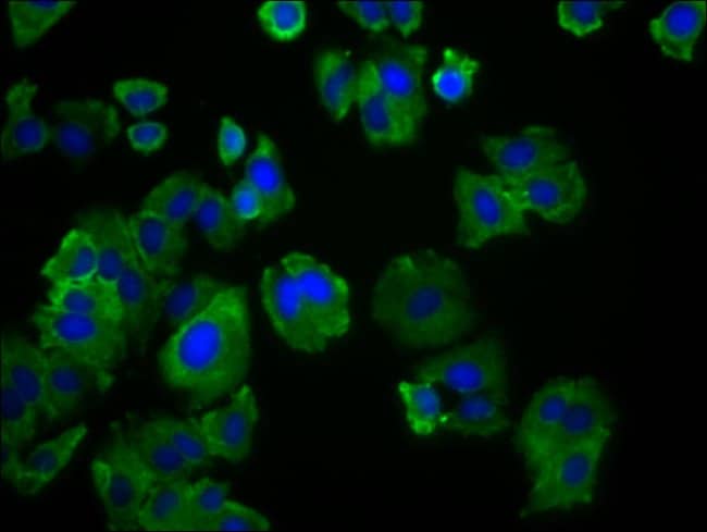 100UG SLC19A3 ANTIBODY 100 ug