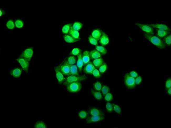 100UG SHARPIN ANTIBODY 100 ug