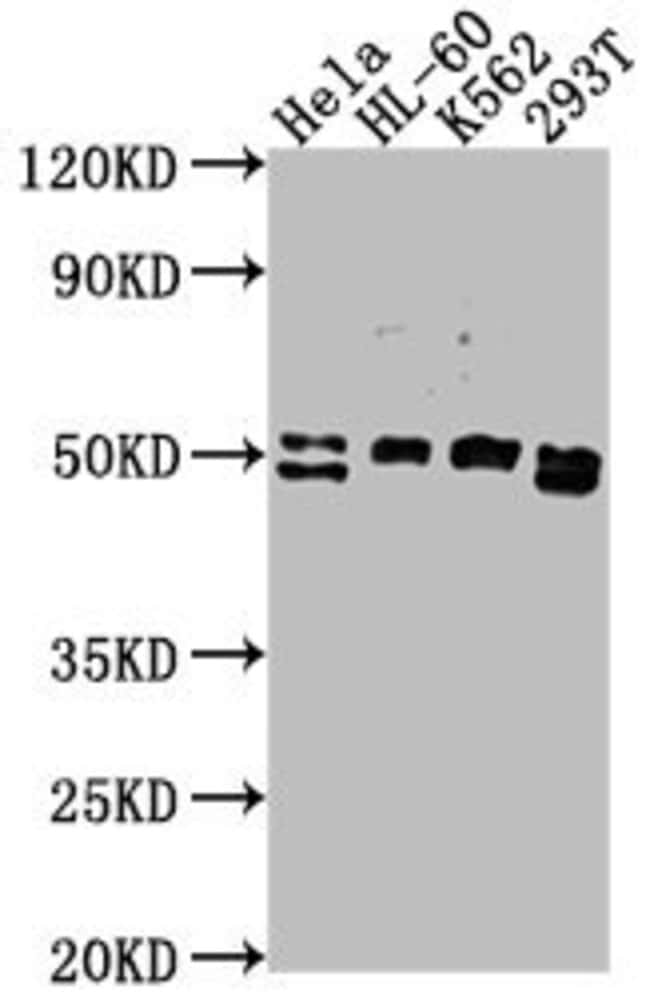 100UL DDX47 ANTIBODY 100 ul