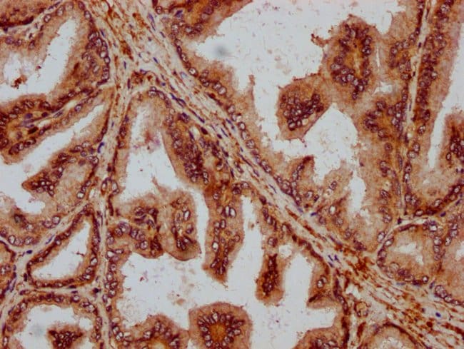 100UG PPA2 ANTIBODY 100 ug