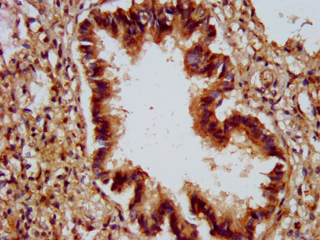 100UG ALG9 ANTIBODY 100 ug