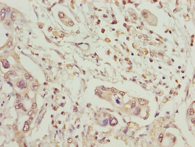 100UL MCCC2 ANTIBODY 100 ul
