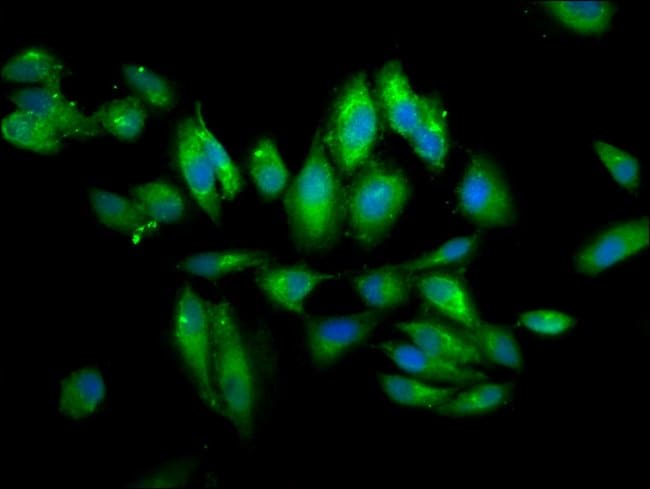100UG PIGV ANTIBODY 100 ug