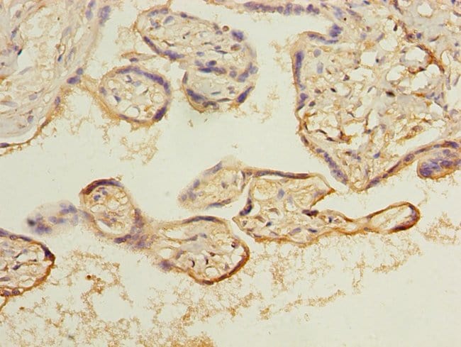 100UG ARL8B ANTIBODY 100 ug