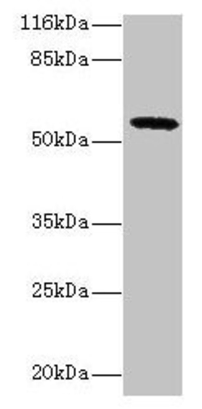 100UG GDAP2 ANTIBODY 100 ug